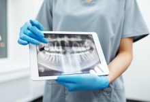 Photo of 5 Common Dental Injuries Caused by Car Accidents